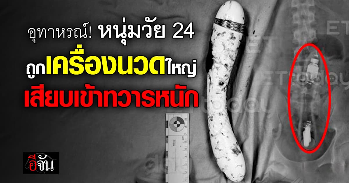 อุทาหรณ์! หนุ่มไต้หวัน ถูกเครื่องนวด 20 ซม. เสียบเข้าทวารหนัก เอาออกไม่ได้