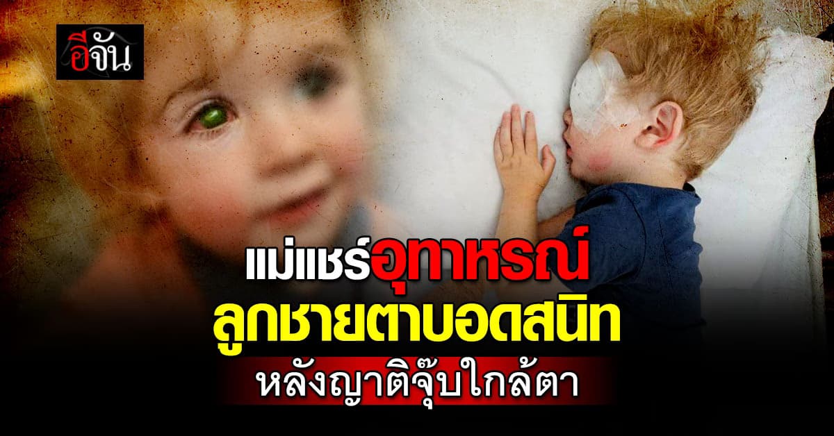 แม่แชร์อุทาหรณ์ ลูกชายตาบอดสนิท หลังญาติจุ๊บใกล้ตา 