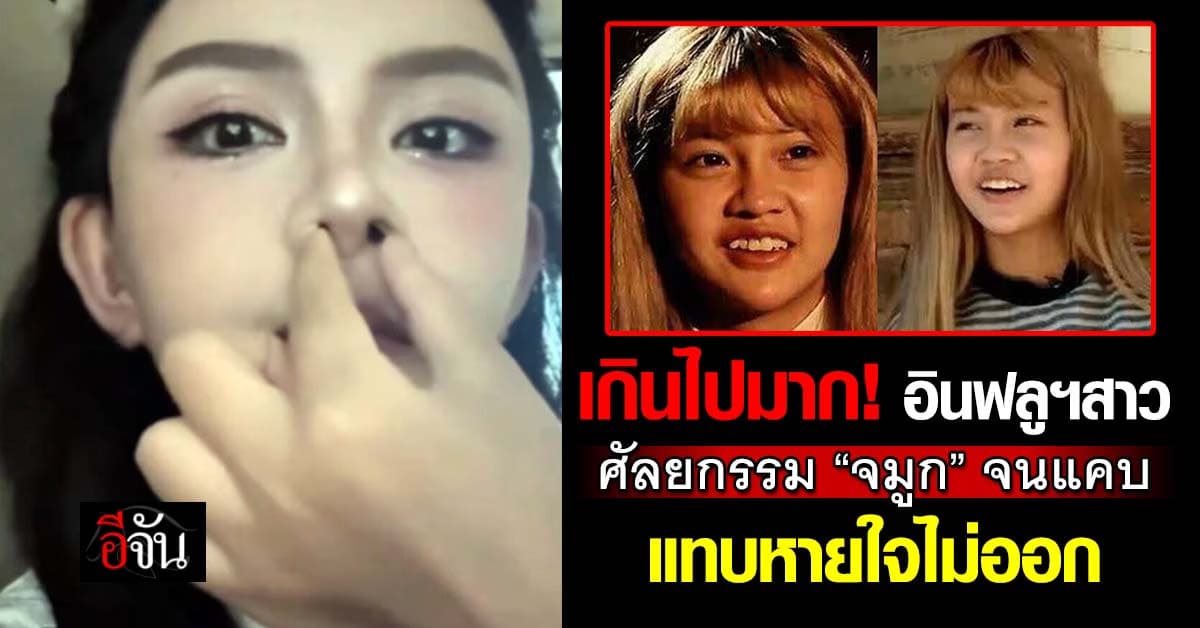 อุทาหรณ์คนชอบทำจมูก! อินฟลูฯสาว ศัลยกรรมจมูกเยอะเกินจนเล็ก-เเคบ แทบหายใจไม่ออก
