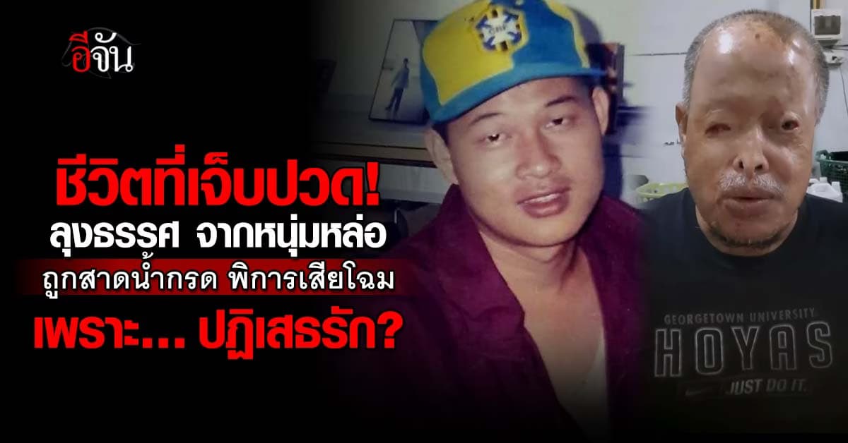 ชีวิตที่เจ็บปวด! ลุงธรรศ จากหนุ่มหล่อ ปฏิเสธรัก ถูกสาดน้ำกรด น่าเสียโฉม