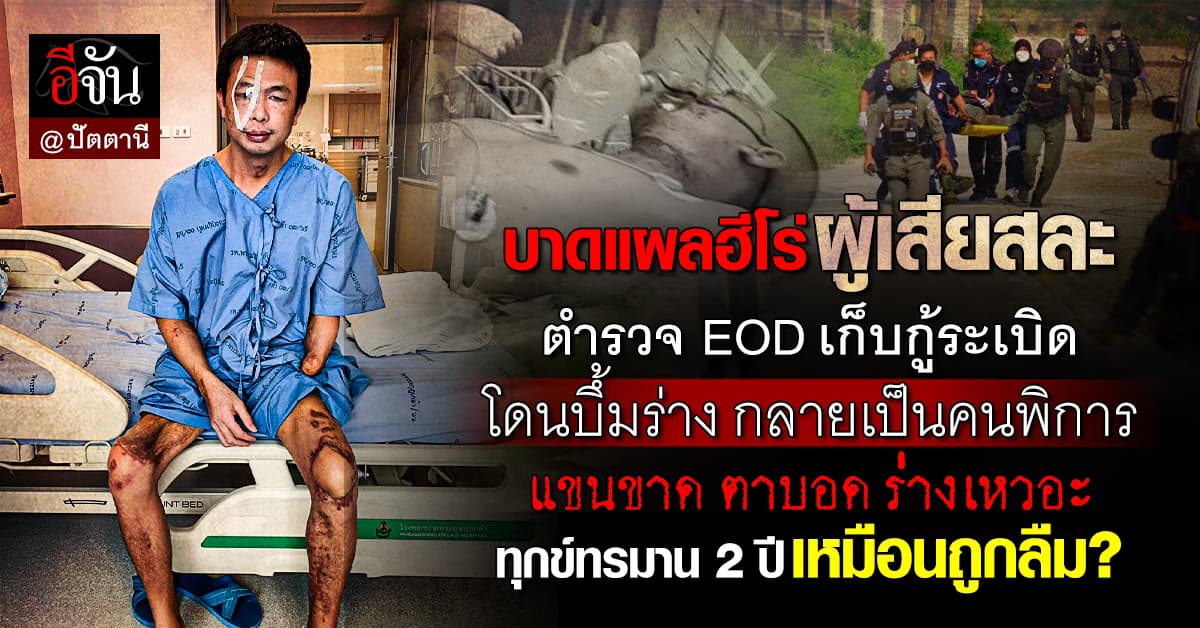 ฮีโร่ ผู้เสียสละ! ด.ต.เกษม เก็บกู้ระเบิดปัตตานี โดนบึ้มร่าง พิการ 2 ปี