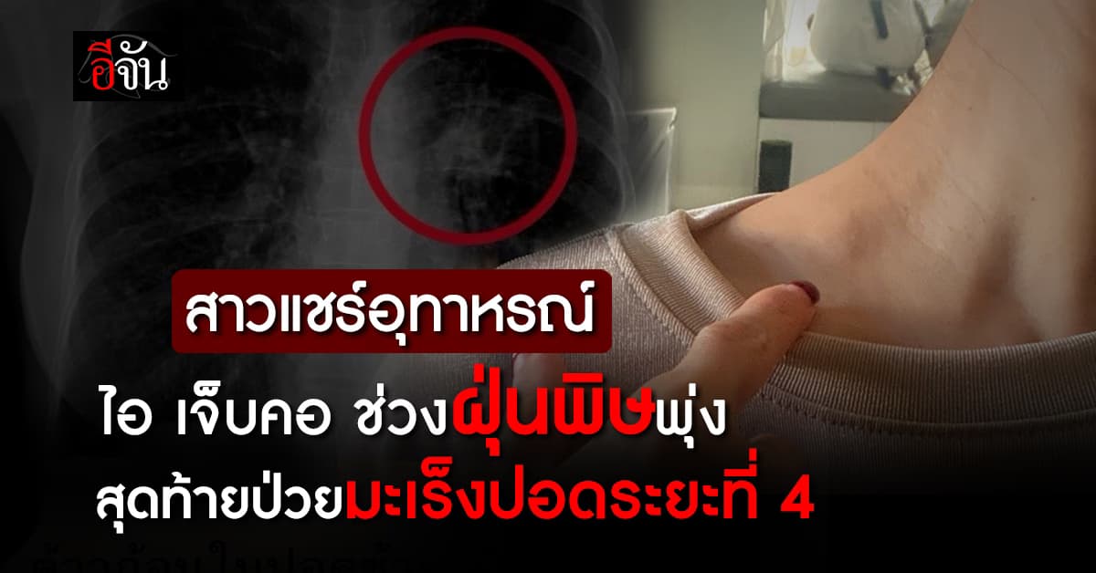 คาด PM2.5 ทำพิษ! สาวแชร์อุทาหรณ์ ป่วยมะเร็งปอดระยะที่ 4 ทั้งที่สุขภาพแข็งแรง-ไม่สูบบุหรี่ 