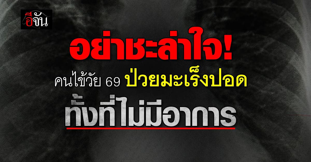 อย่าชะล่าใจ! คนไข้วัย 69 ปี ป่วยมะเร็งปอด ทั้งที่ไม่มีอาการ
