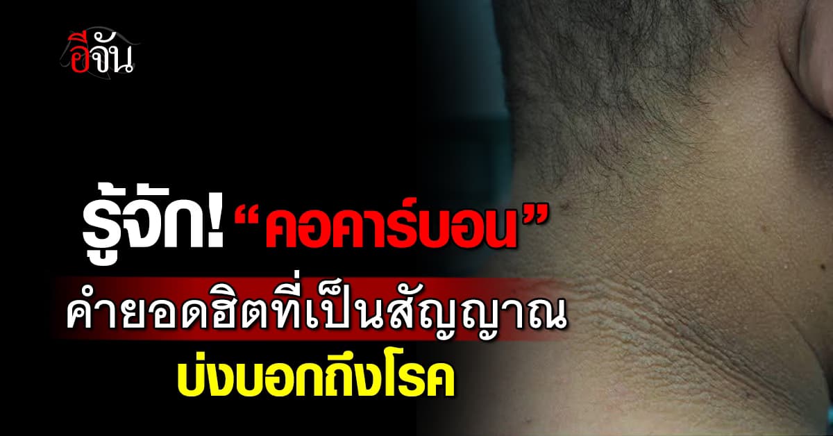 ไขข้อสงสัย! “คอคาร์บอน” คืออะไร? 