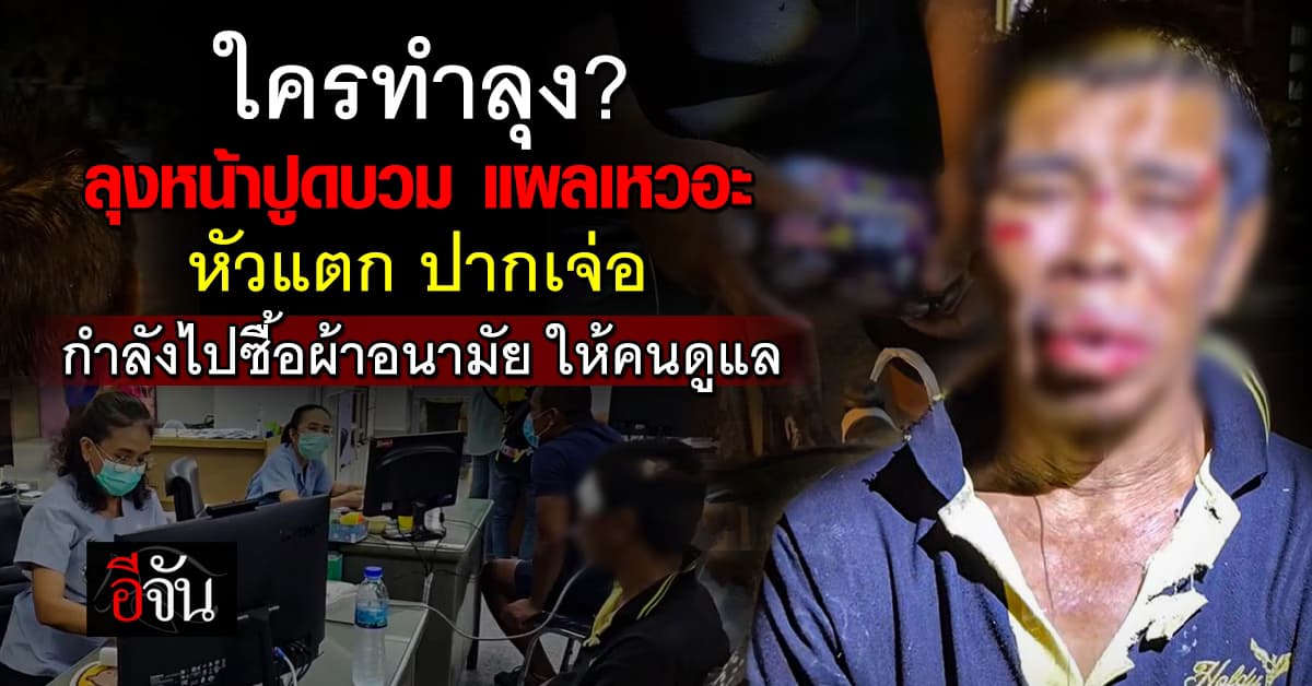 เกิดอะไรขึ้น? ลุงหน้าปูดบวม แผลเหวอะ หัวแตก ปากเจ่อ คนเลี้ยงยัน ไม่ได้ทำร้าย