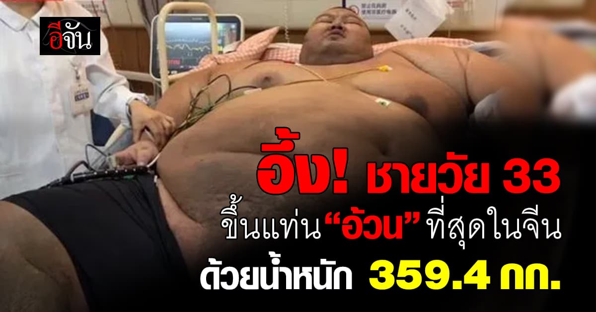 หนุ่มจีนหนักกว่า 300 กก. ลดน้ำหนักใน 55 วัน เกือบเอาชีวิตไม่รอด!  