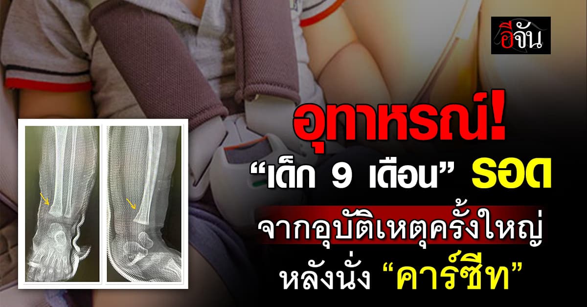 “เด็ก 9 เดือน” รอดหวุดหวิดจากอุบัติเหตุเพราะนั่ง “คาร์ซีท”  