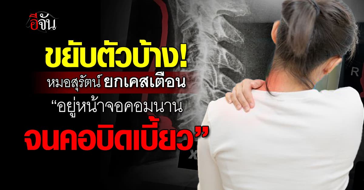 ระวังไว้! หมอ ยกเคสเตือน อยู่หน้าจอคอมนานๆ คอจะบิดเบี้ยวผิดรูป  