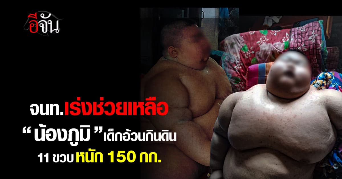 จนท.เร่งช่วยเหลือ “น้องภูมิ” เด็กอ้วนกิน 11 ขวบ หนัก 150 กก. 