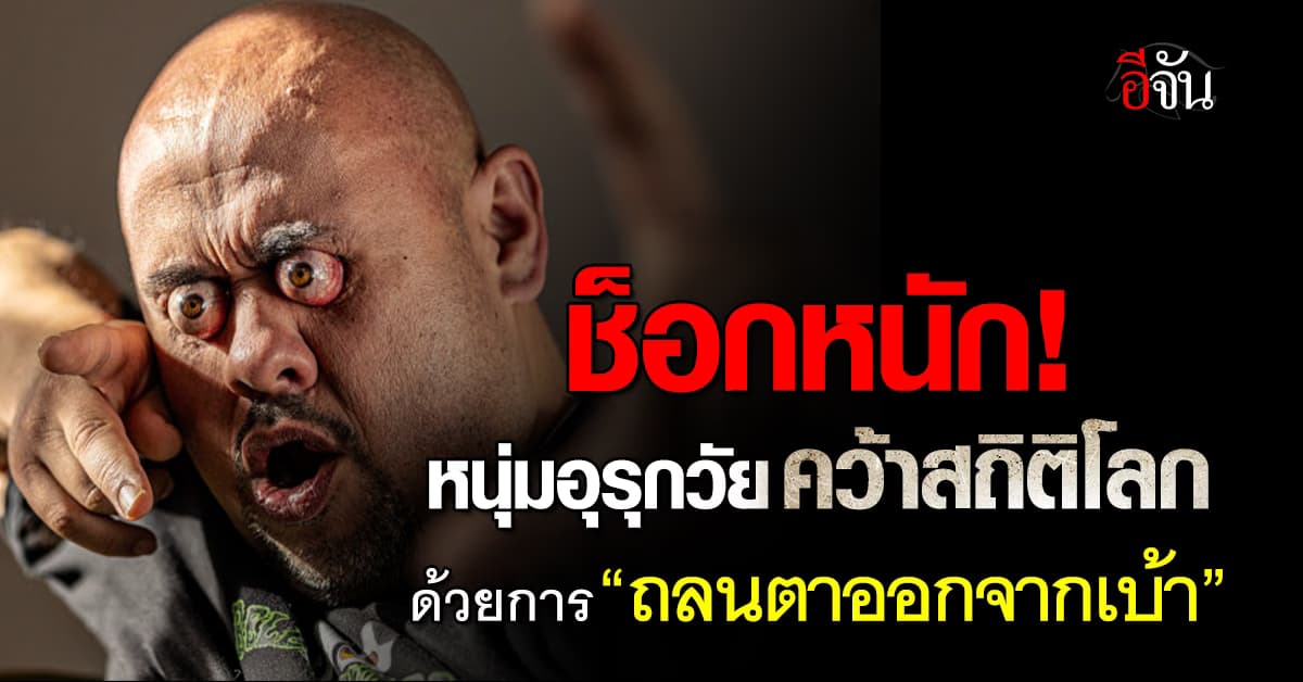 อึ้ง! หนุ่มอุรุกวัย พกความสามารถ “ถลนตาออกจากเบ้า” ทุบสถิติโลก 