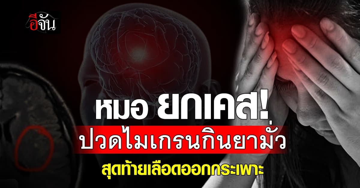 เตือน! หมอสุรัตน์ ยกเคส ปวดไมเกรนกินยามั่วสุดท้ายเลือดออกกระเพาะ