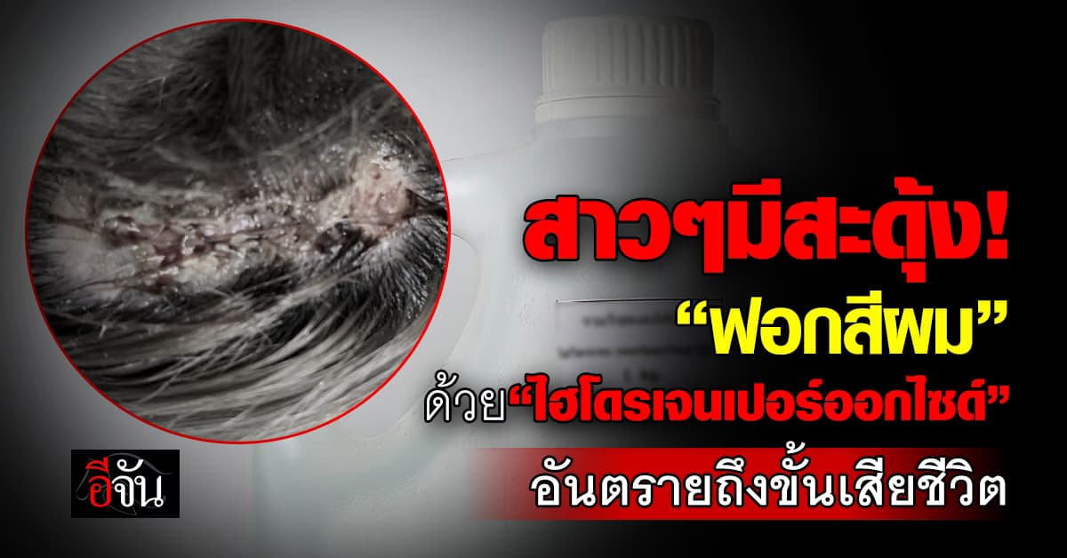 อันตราย! หมอหมู เตือน “ฟอกสีผม”ด้วย “ไฮโดรเจนเปอร์ออกไซด์” ไม่ดีต่อสุขภาพ 