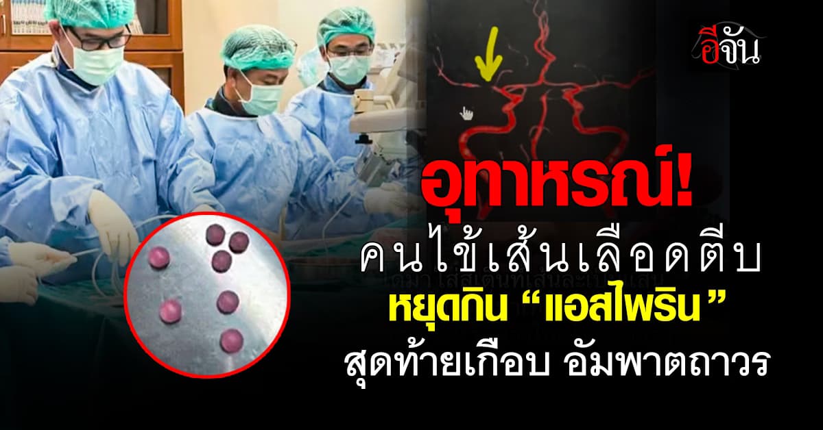 อันตราย! หมอ ยกเคสคนไข้ เป็นเส้นเลือดตีบ แล้วหยุดกินยาเองจนร่างกายทรุด 