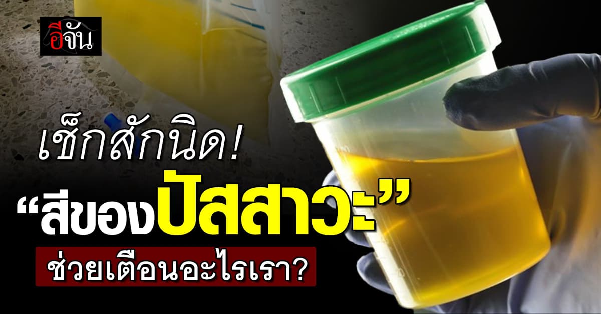 เช็กๆ! “สีของปัสสาวะ” ช่วยเตือนอะไรเราได้บ้าง? 