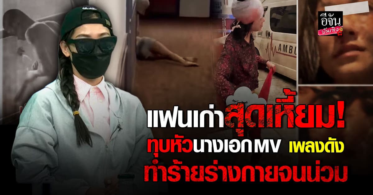 เวทนา นางเอก MV เพลงดัง ถูกแฟนเก่าทำร้ายร่างกายจนน่วม!