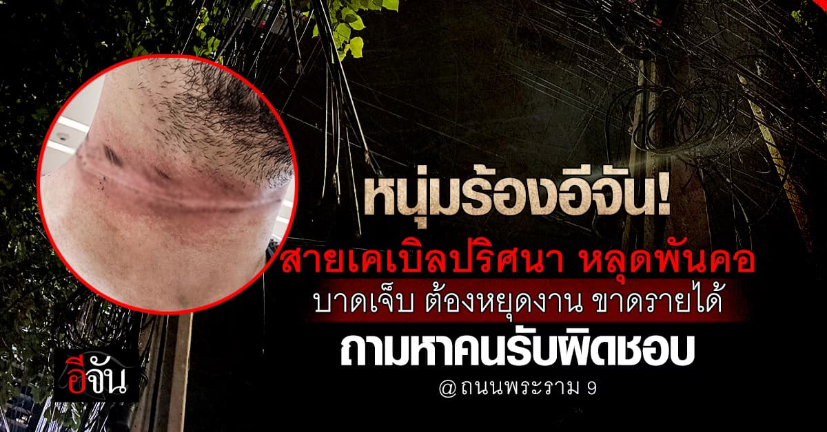หนุ่มร้องอีจัน! ถูกสายเคเบิลปริศนา หลุดพันคอ ร้องหาคนรับผิดชอบ