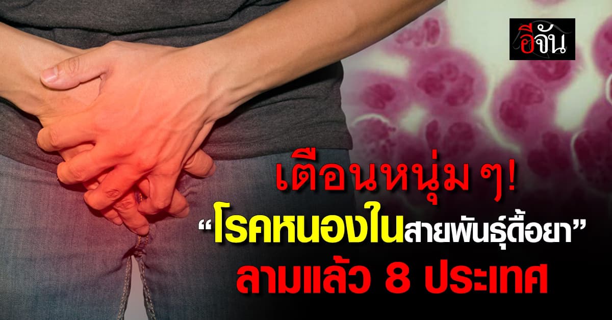 หนุ่มๆ ระวัง! “โรคหนองในสายพันธุ์ดื้อยา” ลามแล้ว 8 ประเทศ  