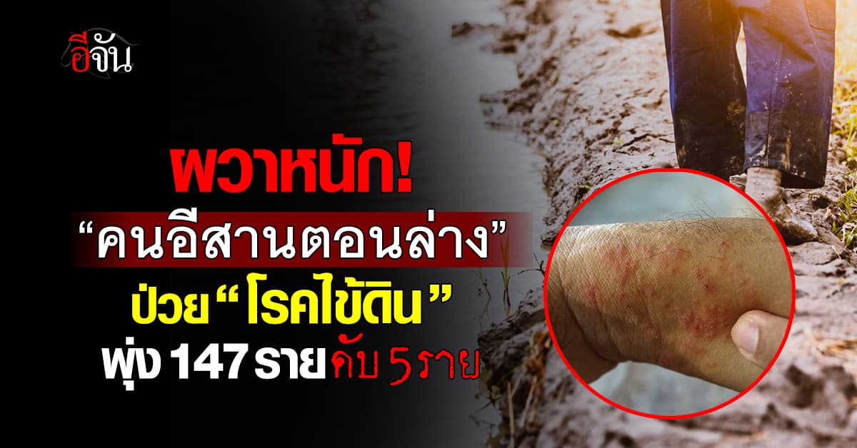 กรมควบคุมโรค เผย! ‘อีสานตอนล่าง’ ป่วย ’โรคไข้ดิน‘ แล้ว 147 ราย  