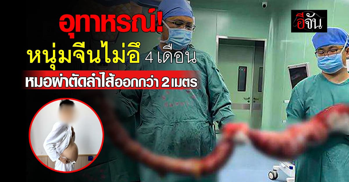 อุทาหรณ์! หนุ่มจีนไม่อึ 4 เดือน หมอผ่าตัดลำไส้ที่เป็นโรค ออกกว่า 2 เมตร 