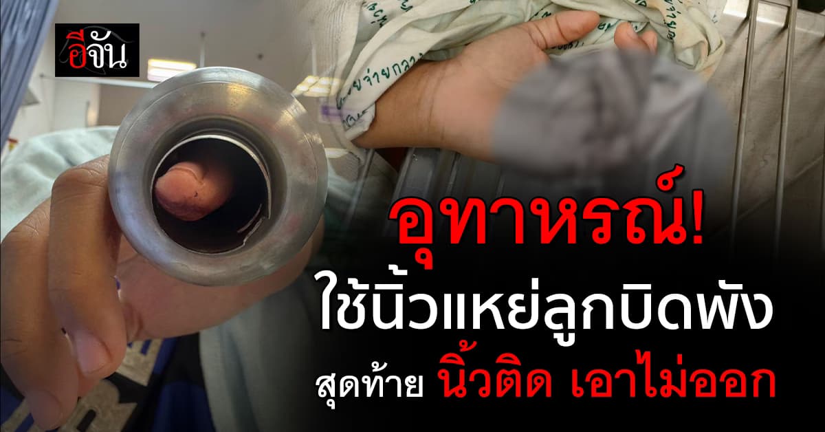 อุทาหรณ์! สาววัย 16 นิ้วแหย่ลูกบิดประตู เอาไม่ออก
