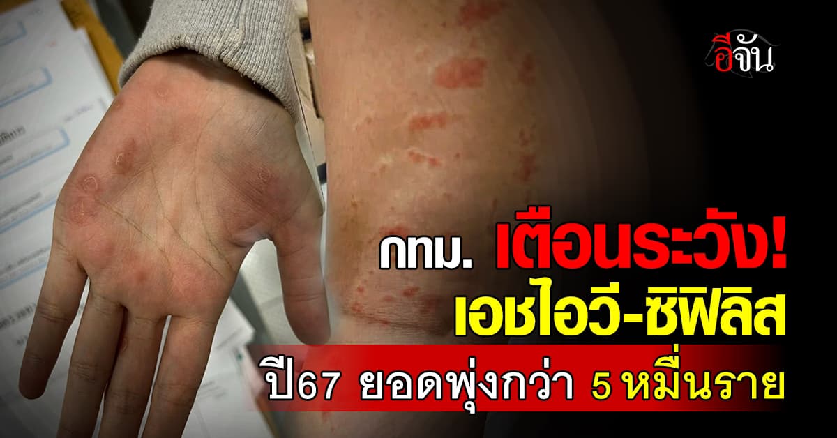 ยืดอก พกถุง! กทม. เตือนระวัง เอชไอวี-ซิฟิลิส ปี67 ยอดพุ่งกว่า 5 หมื่นราย 