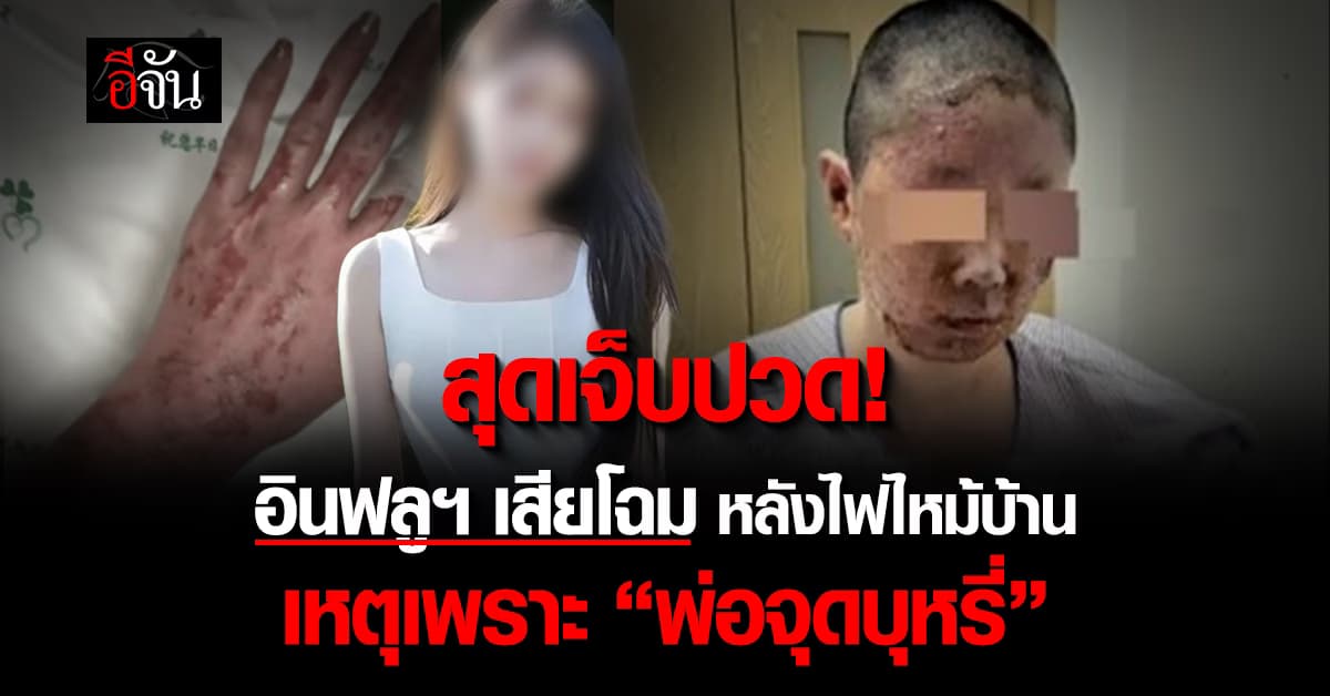 อินฟลูฯ เสียโฉม หลังไฟไหม้บ้าน เหตุเพราะ “พ่อจุดบุหรี่”