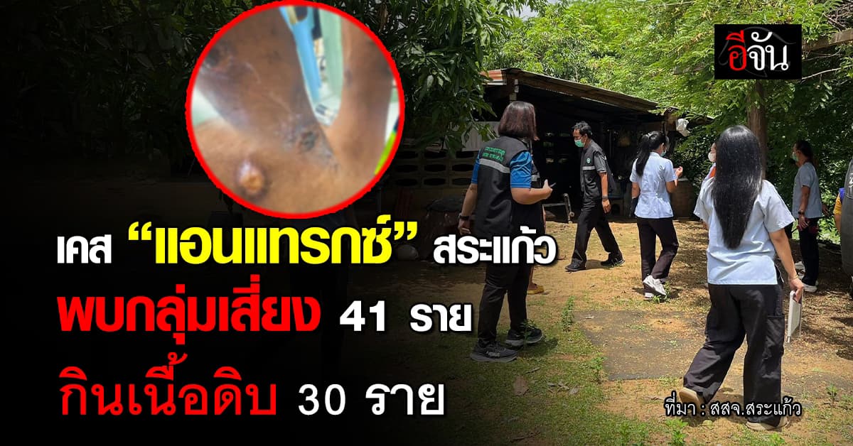 สสจ.สระแก้ว อัปเดตเคส “ป่วยแอนแทรกซ์” พบกลุ่มเสี่ยง 41 ราย กินเนื้อดิบ 30 ราย 