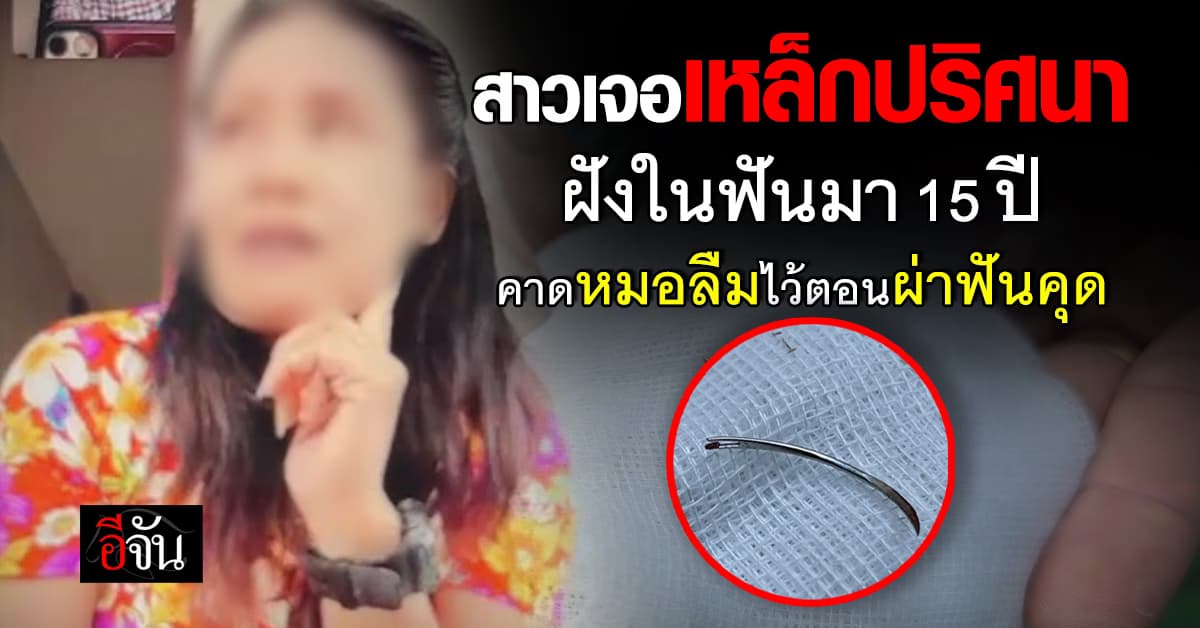 เอ๊ะๆ? สาวเจอเหล็กฝังติดฟัน 15 ปี ทำชาวเน็ตงงกันเป็นเเถบ