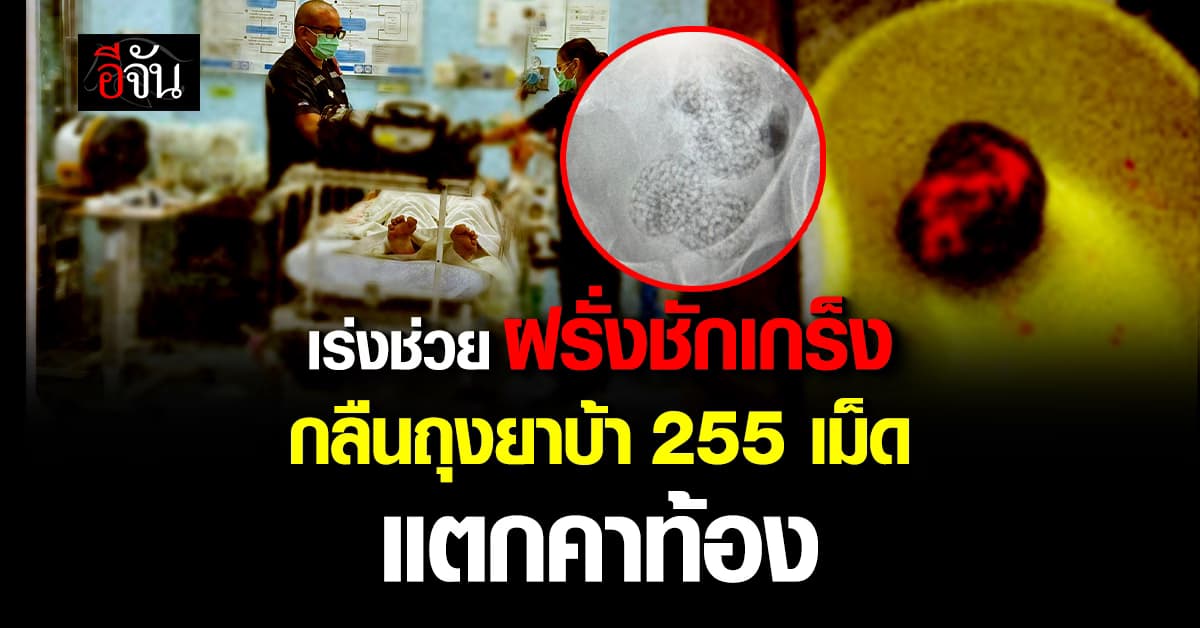 หนุ่มออสเตรีย กลืนถุงยาบ้า 255 เม็ด สุดท้ายแตกคาท้อง