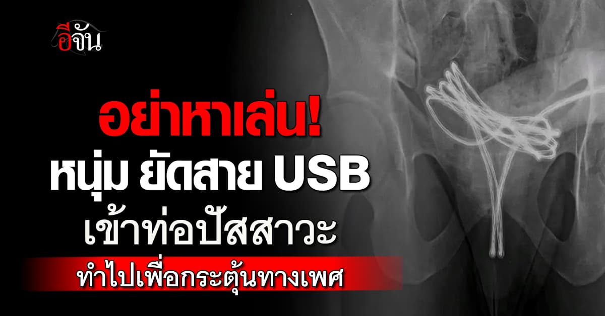ไม่ใช่เรื่องเล่น! หนุ่ม 21 ยัดสาย USB เข้าท่อปัสสาวะ เพื่อสนองตัณหาของตัวเอง 