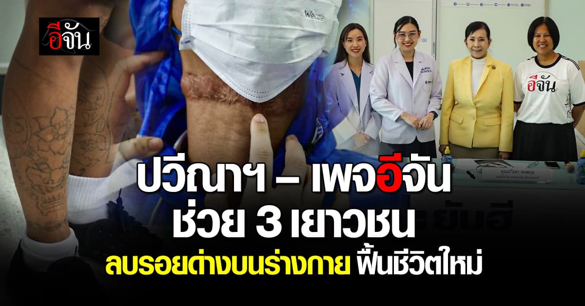 ปวีณาฯ ร่วมกับเพจอีจัน ช่วย 3 เยาวชน ลบรอยด่างบนร่างกาย ฟื้นชีวิตใหม่