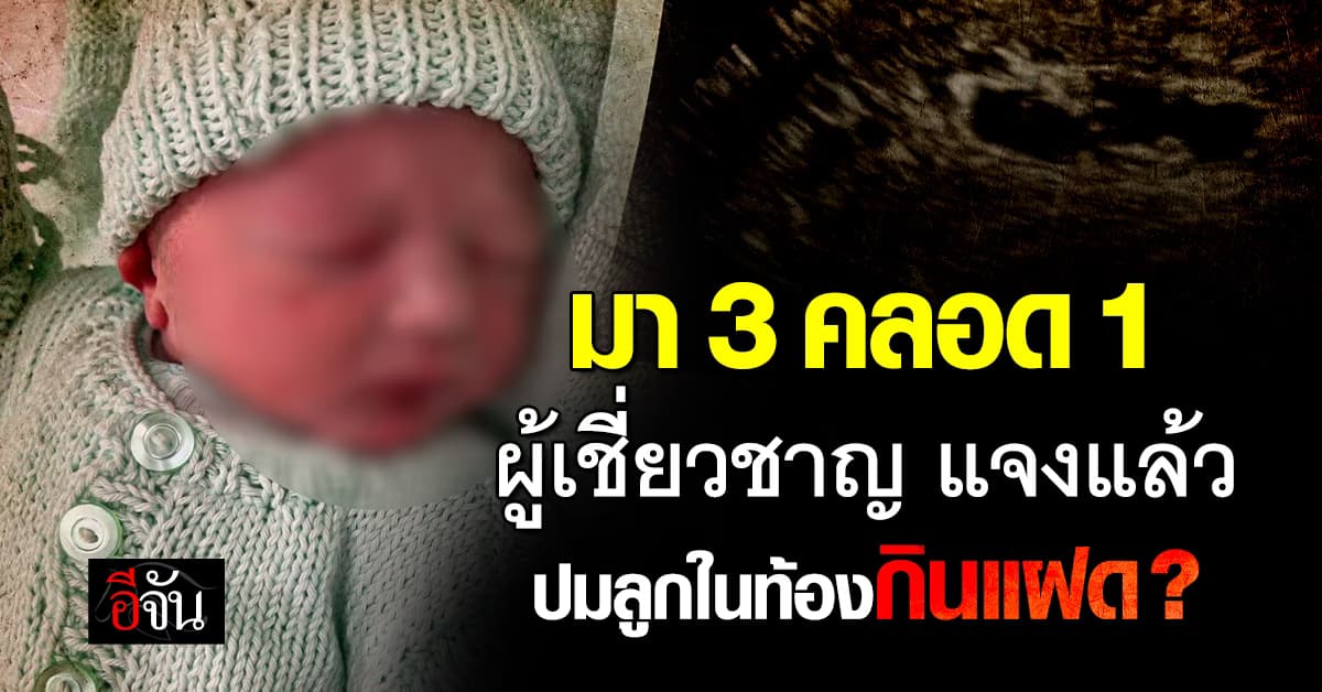 ผู้เชี่ยวชาญ ไขข้อสงสัย ปมลูกในท้องกินพี่น้องฝาแฝด? 