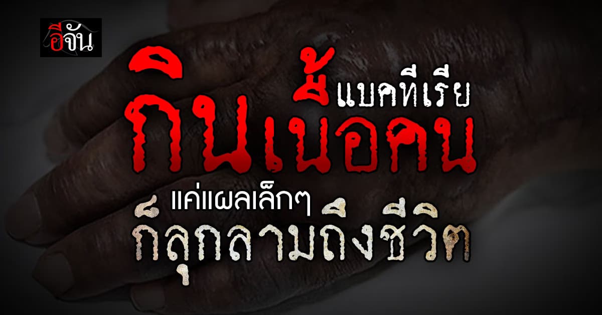 “แบคทีเรียกินเนื้อคน” เกิดขึ้นได้กับทุกคนและหากปล่อยไว้อันตรายถึงชีวิต