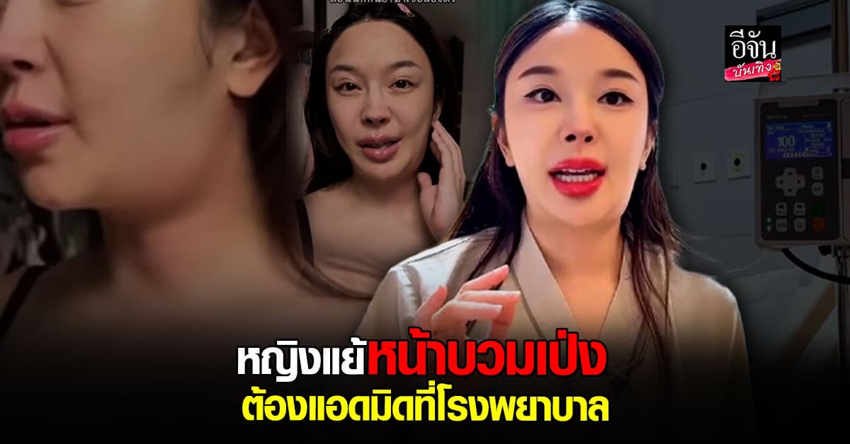 ขอบคุณทุกกำลังใจ หญิงแย้ นนทพร ต้องแอดมิท หลังมีอาการหน้าบวม