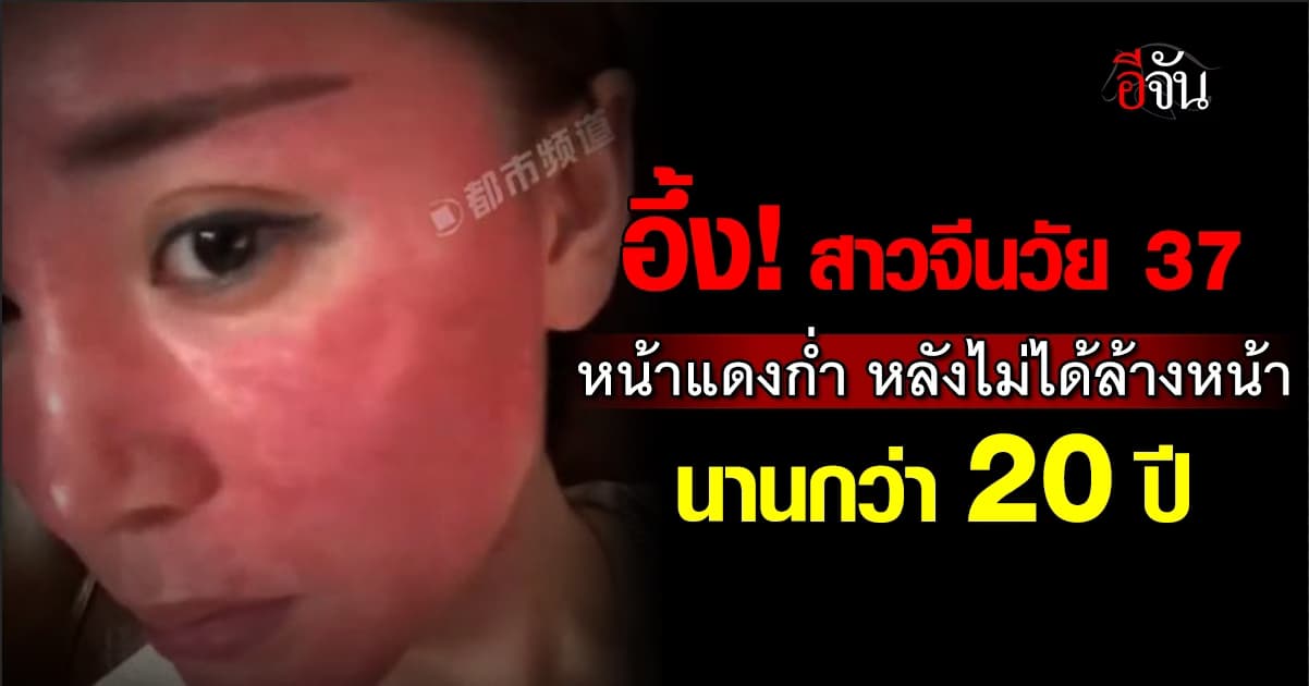 สาวจีนวัย 37 อึ้งหนัก! หลังหน้าแดงก่ำเพราะไม่เคยเช็ดเครื่องสำอางนาน 22 ปี  