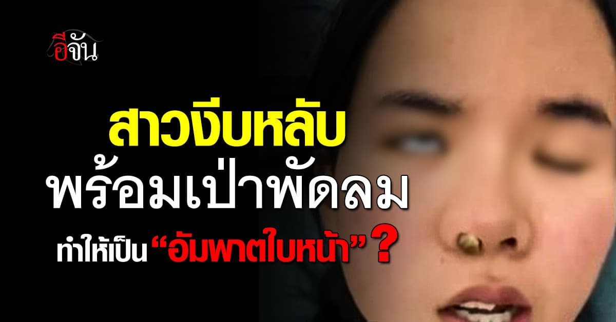 สาวจีนงีบหลับพร้อมเป่าพัดลม ทำให้เป็น “อัมพาตใบหน้า” ได้จริงหรือ?
