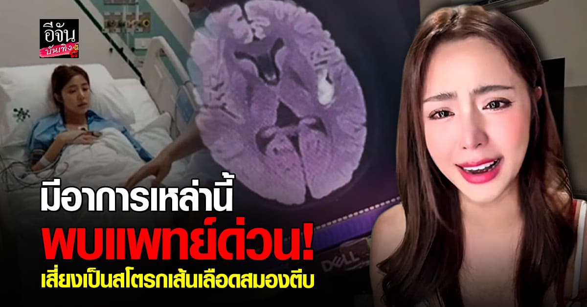 ตังตัง นัฐรุจี แชร์ประสบการณ์เป็นสโตรกในวัยเลข 3