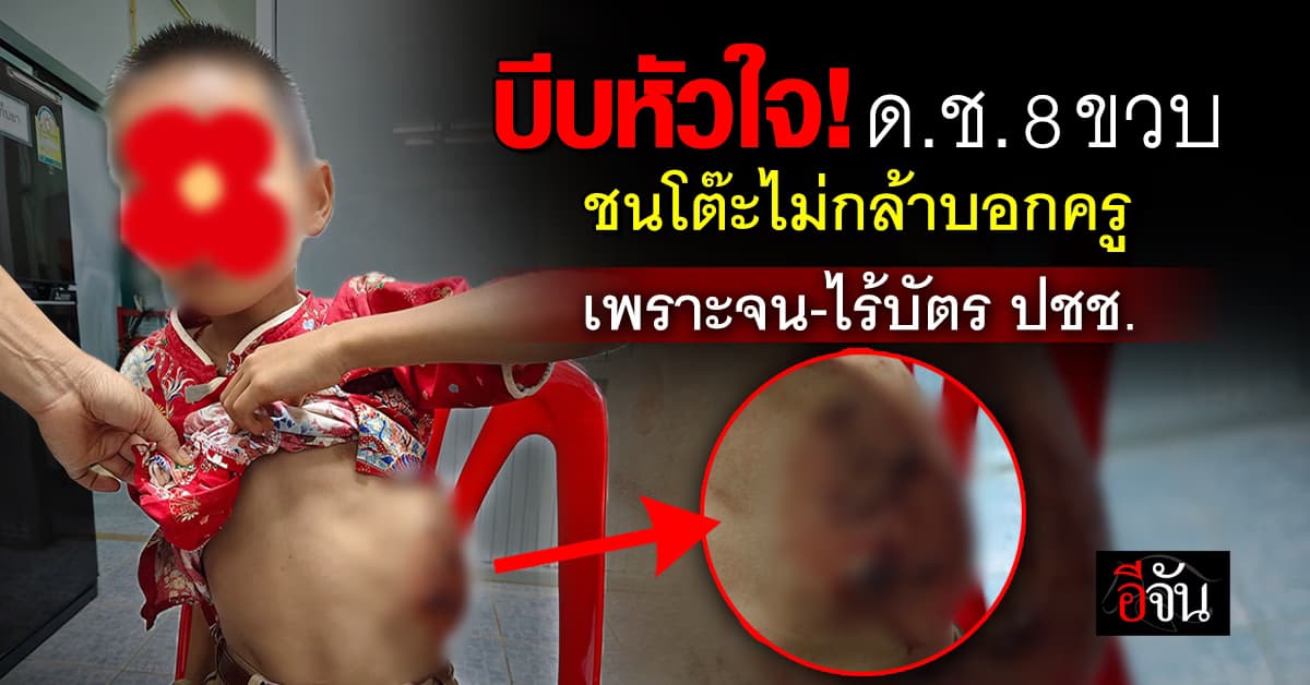 บีบหัวใจ! ด.ช. 8 ขวบ ชนโต๊ะไม่กล้าบอกครู ปล่อยไว้จนบวม เพราะจน-ไร้บัตร ปชช.