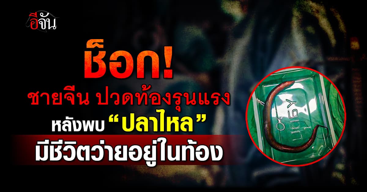 หมอผงะ! หลังพบ “ปลาไหล“ มีชีวิต ว่ายอยู่ในท้องคนไข้ 