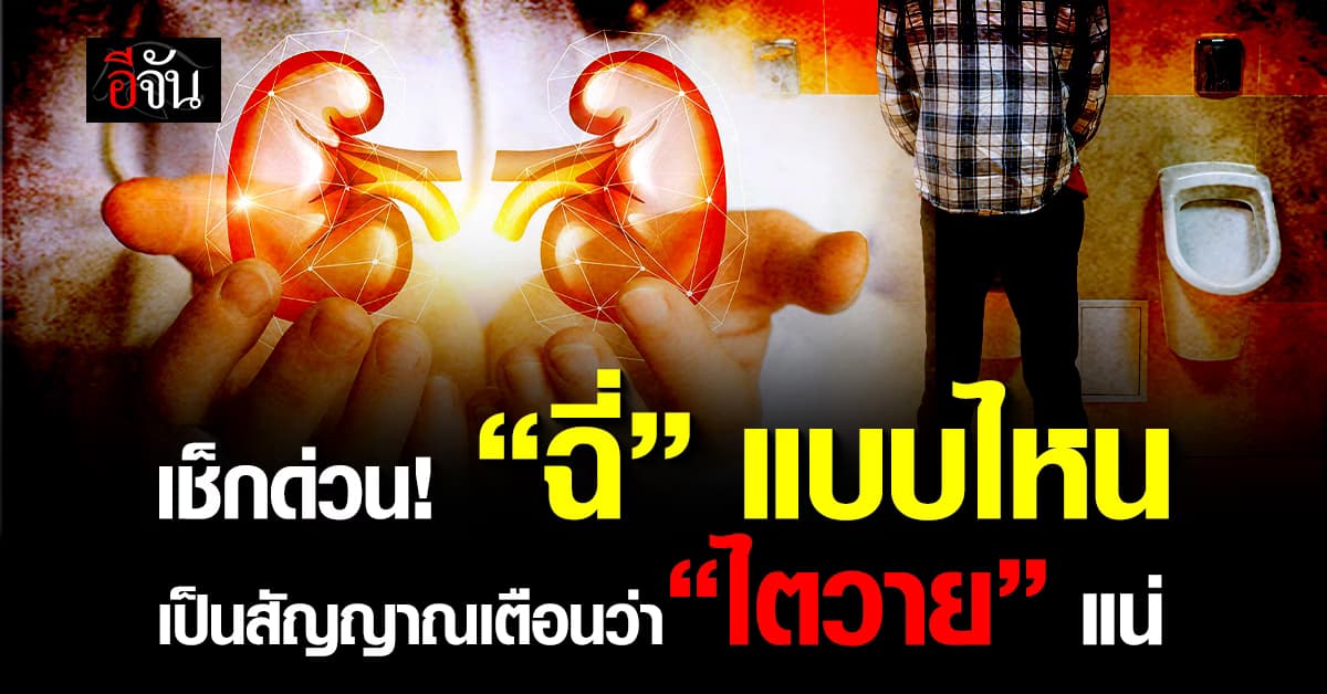 มองข้ามไม่ได้! “เยี่ยว” หรือ ปัสสาวะ อาจเป็นสัญญาณว่า “ไต” ของเรามีปัญหา 