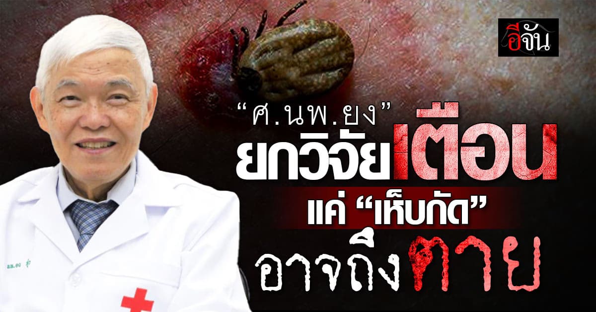 “ศ.นพ.ยง” ยกงานวิจัยเตือน แค่ “เห็บกัด” อาจถึงตาย 