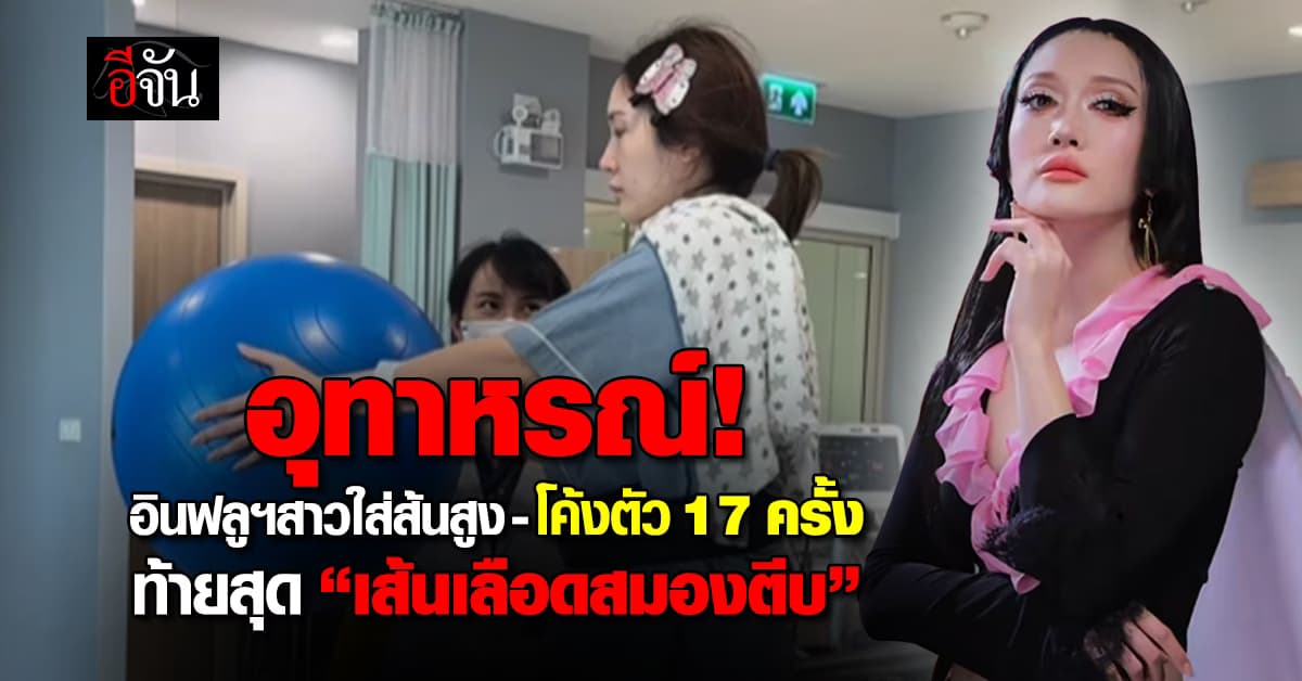 อุทาหรณ์! อินฟลูฯสาว วูบ หลังใส่ส้นสูง-โค้งตัว 17 ครั้ง จนเส้นเลือดสมองตีบ 