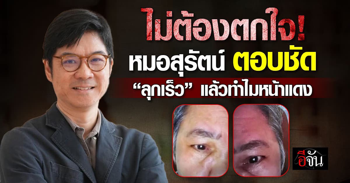 ไม่ต้องตกใจ! หมอสุรัตน์ ตอบชัด ทำไมเวลาลุกเร็วแล้วมีอาการหน้าแดง   