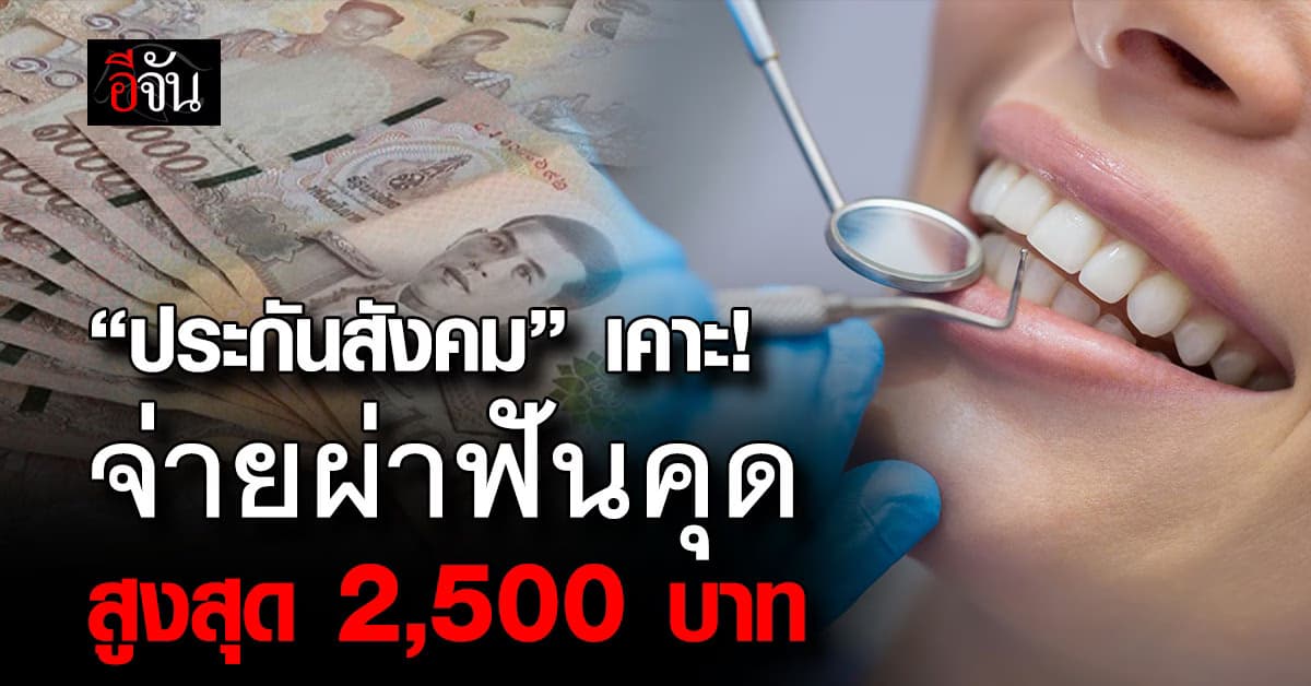 “ประกันสังคม” เคาะแยกสิทธิผ่าฟันคุด จ่ายสูงสุด 2,500 บาท 