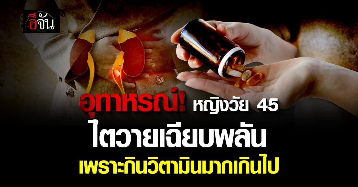 อุทาหรณ์! หญิงวัย 45 ปี ไตวายเฉียบพลัน เพราะกินวิตามิน-ยาบำรุง มากเกินไป