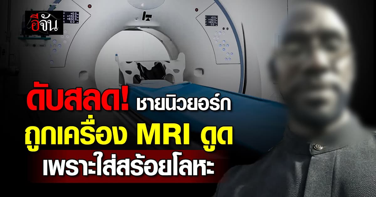 ดับสยอง! ชายถูกเครื่อง MRI ดูดกระแทก เพราะสร้อยโลหะเส้นเดียว 