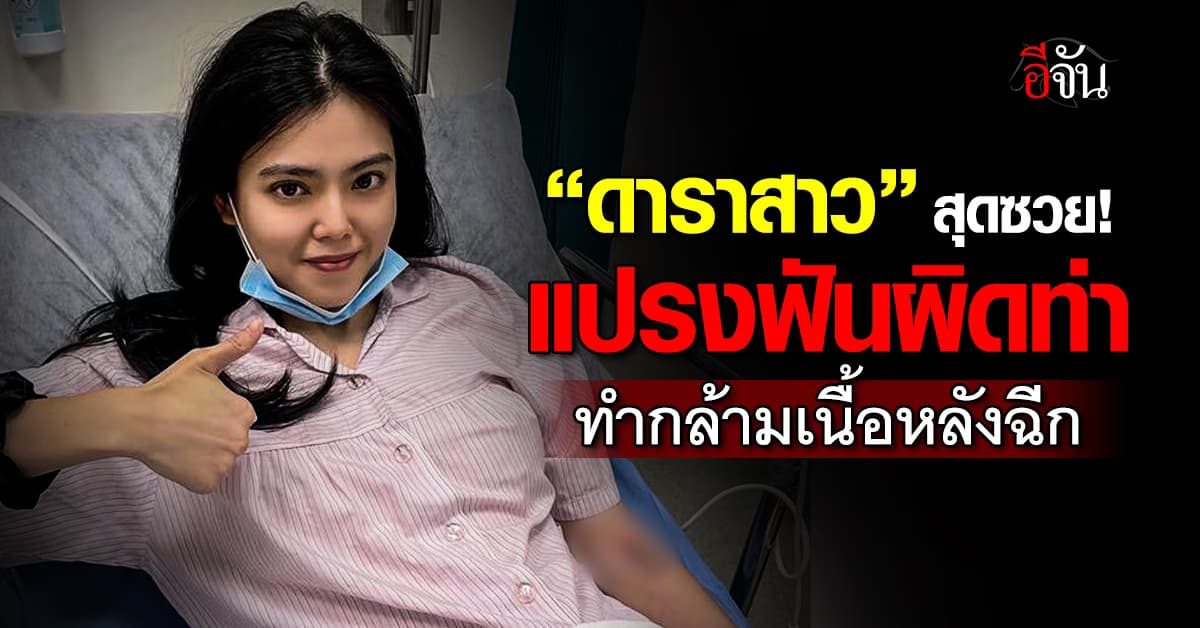 “ดาราสาว” สุดซวย! แปรงฟันผิดท่า จนกล้ามเนื้อฉีก