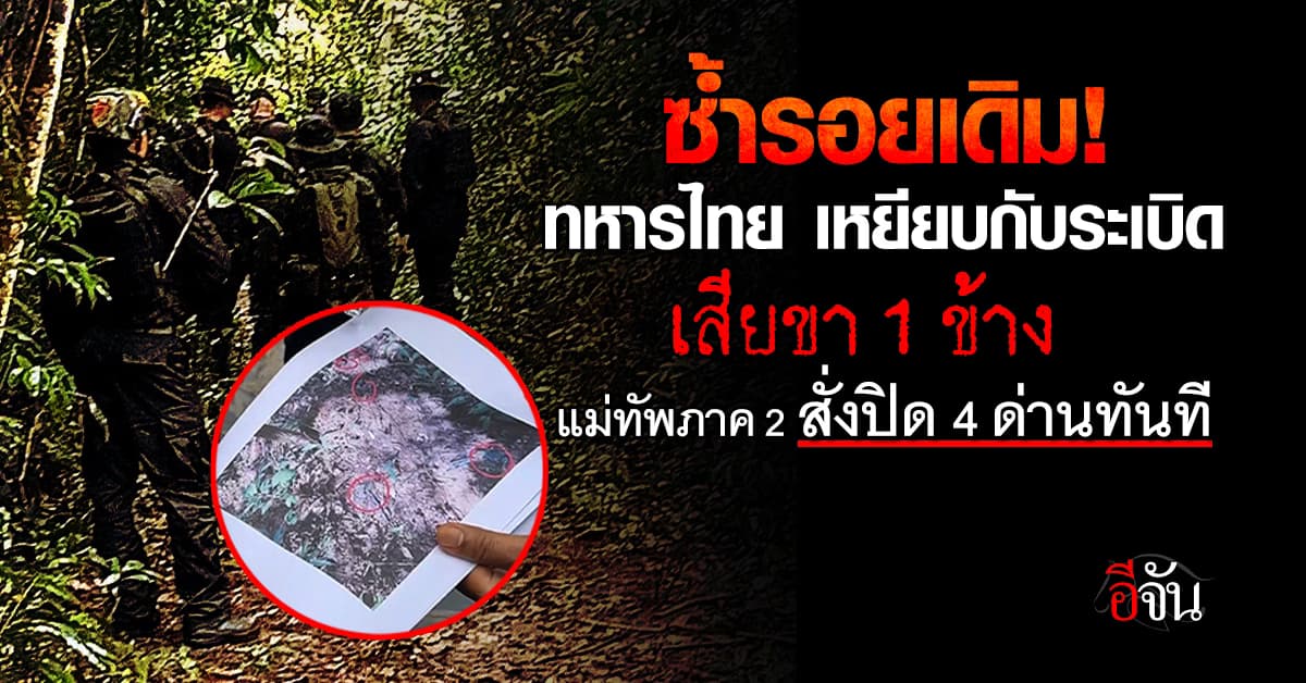 อีกแล้ว! ทหารไทย เหยียบกับระเบิดซ้ำ ที่ช่องอานม้า ขาขาด มทภ. 2 สั่งปิดด่านทันที