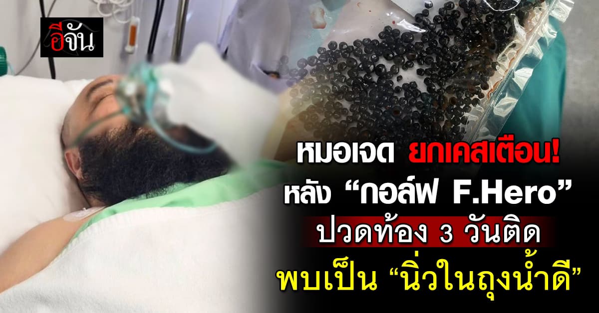 หมอเจด ยกเคสเตือน หลัง “กอล์ฟ F.Hero” ปวดท้อง 3 วันติดเพราะเป็นสิ่งนี้  