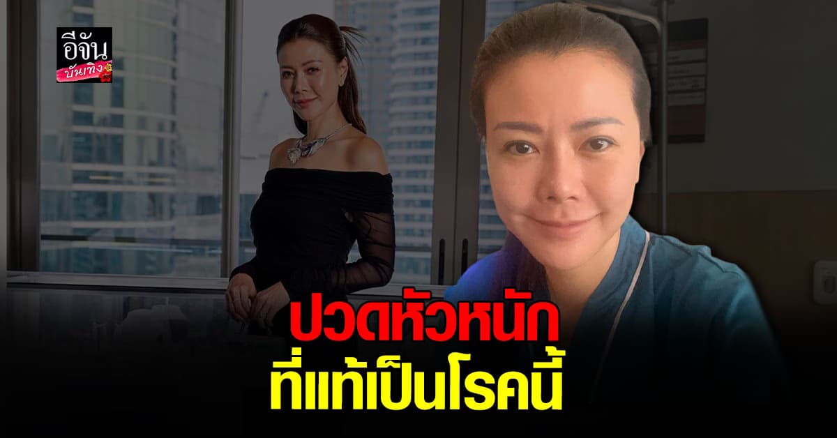 ปวดหัวหนักไม่ใช่ไมเกรน เก๋ ชลลดา เจอโรค เริมขึ้นสมอง หมอสั่งงดงานด่วน